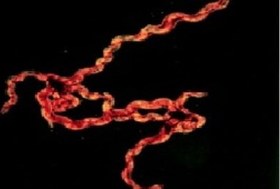 تصویر باکتری های Spirochetes 