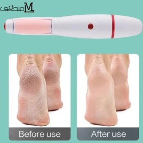 تصویر سنگ پا برقی FIND BACK 