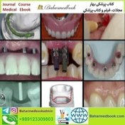 تصویر A Z in Restorative Implant Dentistry Series video course price 36€ 