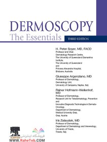 تصویر دانلود کتاب Dermoscopy: The Essentials [3&nbsp;ed.] کتاب انگلیسی درموسکوپی