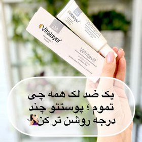 تصویر کرم روشن کننده ویتالایر مدل وایت ویت (Whitevit) 