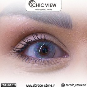 تصویر لنز CHIC VIEW 1ساله مدت زمان استفاده هفتگی فیلتراشعه فرابنفش 