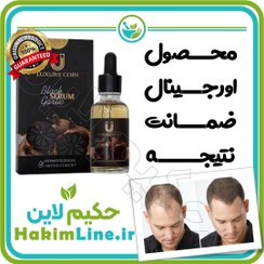 تصویر سرم سیر سیاه اصل Black Garlic Serum – معجزه رویش مو (ضمانت اصالت کالا) 