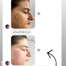 تصویر کرم ضد لک لاکچری کوین حجم ۵۰ میلی لیتر 