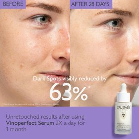 تصویر سرم روشن کننده وینوپرفکت جایگزین ویتامین C کدلی Vinoperfect Radiance Serum Vitamin C Alternative | Caudalie