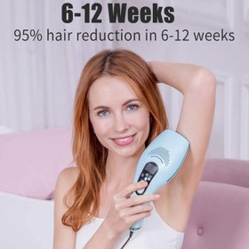 تصویر لیزر موهای زائد مدل DEESS Permanent Hair Removal System - ارسال 20 روز کاری 