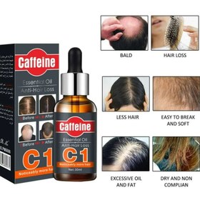 تصویر روغن ضروری مراقبت از مو با کافئین ضد ریزش مو 30 میلی‌لیتر برند pei mei Caffeine Anti-Hair Loss Essential Oil Hair Care 30 ml