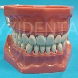 تصویر ماکت دندان فاندوم چانه