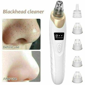 تصویر دستگاه میکرودرم پاکسازی موتور سنگین 