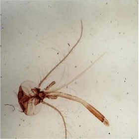 تصویر میکروسکوپ مدل Focus 2-speed 