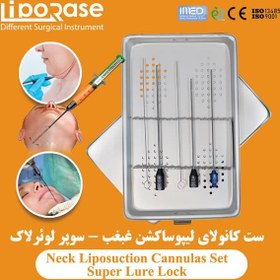 تصویر ست کانولای لیپوساکشن غبغب سوپر لوئرلاک 2 لیپوریس Neck Liposuction Cannula Set-Super Lure Lock 