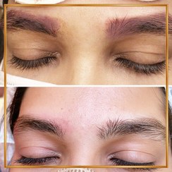 تصویر ریمو ابرو 