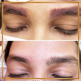 تصویر ریمو ابرو 