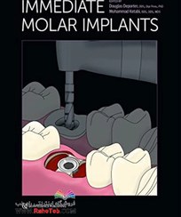 تصویر Immediate Molar Implants Kindle Editionایمپلنت مولر فوری 