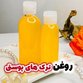 تصویر روغن گیاهی رفع ترک پوستی 