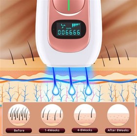تصویر دستگاه لیزر اصلاح موهای بدن Aminzer - IPL Hair Removal Device PA2 