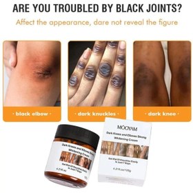 تصویر کرم سفید کننده زانو و آرنج مویام 