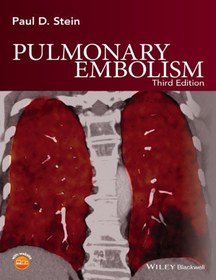 تصویر آمبولی ریه؛ ۲۰۱۶ Pulmonary Embolism 2016