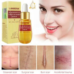 تصویر سرم اسکار و رفع جای جوش لانبنا(تی سی ام) Scar removal serum