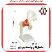 تصویر مولاژ لگن و استخوان ران با نمایش رباط ها Moulage of the pelvis and femur with ligaments