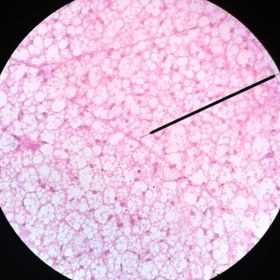 تصویر لام میکروسکوپی چربی قهوه ای (آ) (آموزشی) Microscopic slide of brown fat (a) (educational)