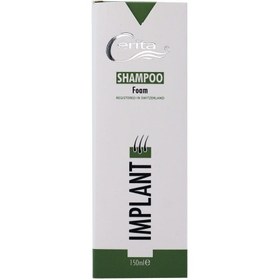 تصویر شامپو فوم سریتا مناسب موهای کاشته شده حجم ۱۵۰ میلی لیتر 