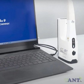 تصویر اسکنر داخل دهانی پاندا P4 (Panda Wireless) 