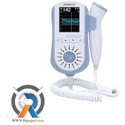 تصویر جنین یاب سونیکید مدل JPD-100E پرتابل 