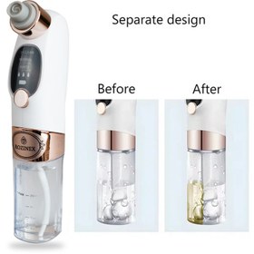 تصویر میکرودرم روزینکس مدل بخوردار 