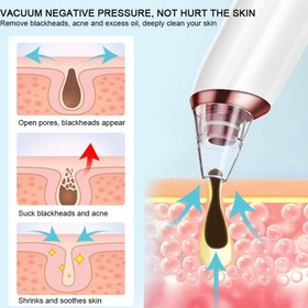 تصویر میکرودرم مدل KNY-E27 