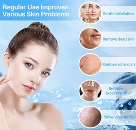 تصویر دستگاه میکرودرم ابریژن الماس، دستگاه میکرودرم ابریژن 3 حالته الماس NALACAL 032485 برای از بین بردن جوش سر سیاه، ابزار مراقبت از پوست صورت، دستگاه میکرودرم ابریژن حرفه ای مسافرتی خانگی قابل حمل - ارسال 30 روز کاری 