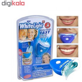 تصویر سفید کننده دندان وایت لایت مدل White Light Tooth Whitening System 