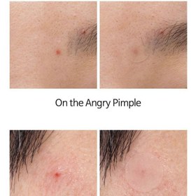 تصویر چسب ضدجوش تیام چسب-ضد-جوش-تیام-TIA'M