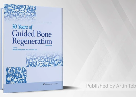 خرید و قیمت 30Years of Guided Bone Regeneration in Implant Dentistry | ترب