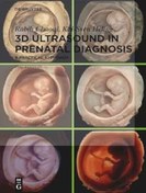 تصویر دانلود کتاب 3D Ultrasound in Prenatal Diagnosis: A Practical Approach 2nd edition 