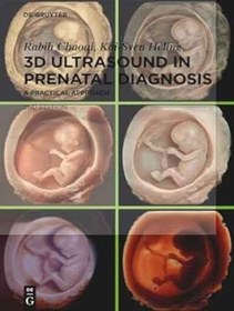 تصویر دانلود کتاب 3D Ultrasound in Prenatal Diagnosis: A Practical Approach 2nd edition 