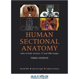 تصویر دانلود کتاب Human Sectional Anatomy: Atlas of Body Sections, CT and MRI Images آناتومی مقطعی انسان: اطلس برش های بدن، تصاویر سی تی و ام آر آی