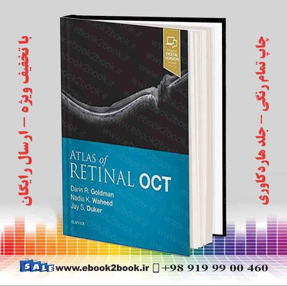 خرید و قیمت Atlas of Retinal OCT: Optical Coherence Tomography 1st 2018 ...