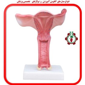تصویر مولاژ رحم و تخمدان Mollage of the uterus and ovaries