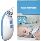 تصویر پوار بینی برقی نوزاد 