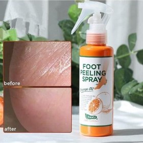 تصویر اسپری ترک و خشکی پا foot peeling spray 