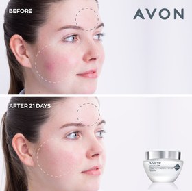 تصویر کرم صورت با دوبرابر کلاژن برای پوست حساس Avon Anew Sensitive Dual Collagen 