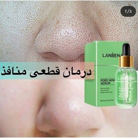 تصویر چسب بینی لانبنا 17 گرمی همراه 100 برگه با جوشای سر سیاهت خداحافظی کن 