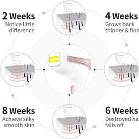 تصویر لیزر موهای زائد مدل BoSidin Permanent Hair Removal Device - ارسال 20 روز کاری 