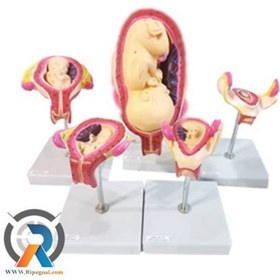 تصویر مولاژ مراحل بارداری 5 تیکه ا Fetal stage model Fetal stage model