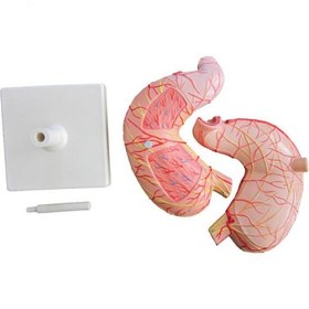 تصویر مولاژ معده 