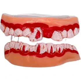 تصویر دندان لثه ای هالووینی 