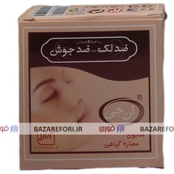 تصویر صابون گیاهی ضد لک و جوش 50 گرمی از برند ان جی - بازار فوری Herbal anti-blemish a​nd acne soap 50 grams from NG bra​nd