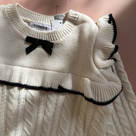 تصویر بافت پاپیونی 