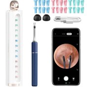 تصویر اتوسکوپ معاینه گوش و جرمگیر مجهز به دوربین 